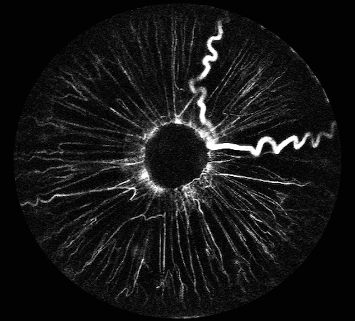 Second Place in the Fluorescein Angiography Category: Unknown 