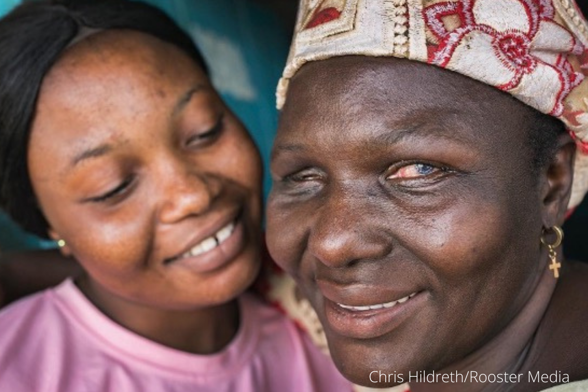 Woman post cornea transplant