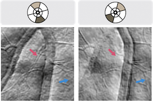 Fig 2 vessel impact