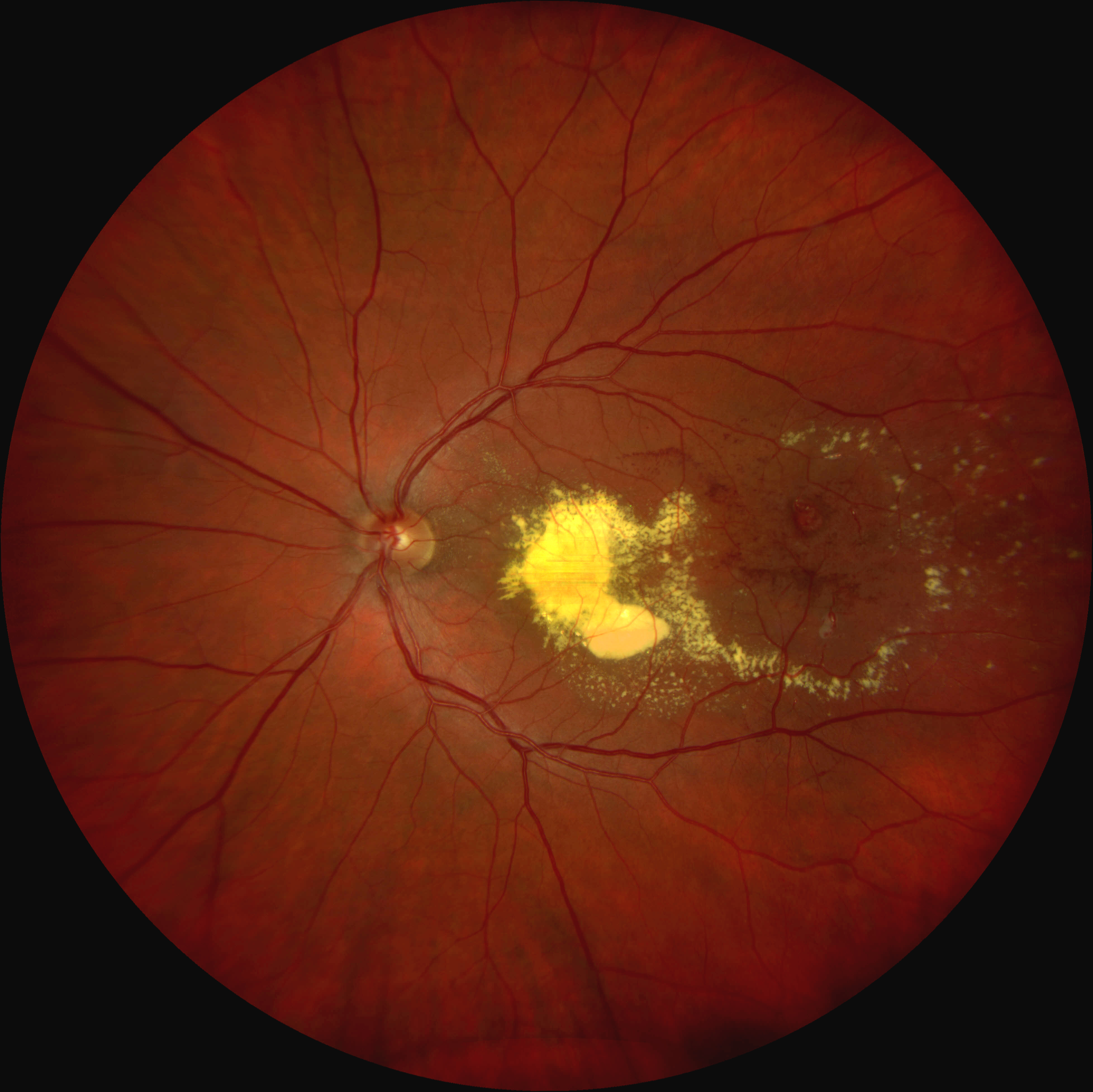 Kelly photo - fundus