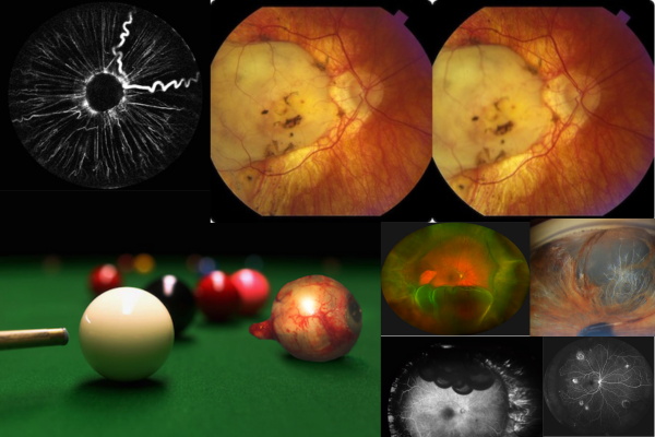 Duke Ophthalmic Photographers Earn Awards At American Academy Of ...