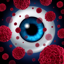 ocular immunology