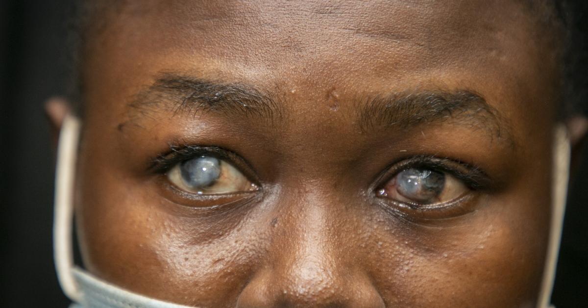 What Do Blind People Eyes Look Like