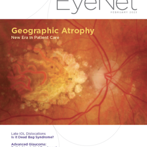 Eyenet cover