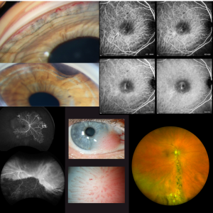 ASCRS photo compilation