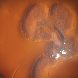 Eye
