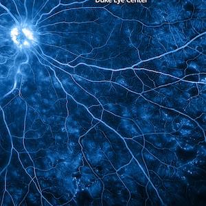 Vision cover
