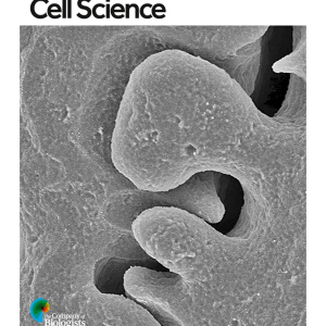 Journal of Cell Science December 2024 issue cover feature. Image of Ankyrin-B shows impaired establishment of BS lateral membrane interdigitations between adjacent fiber cells compared to controls 